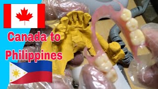 Flexible Dentures From Canada to Philippines [upl. by Oyam]