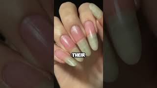 DONOT grow your nails 💅😨 [upl. by Eillib]