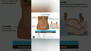 Fundal height measurement education ministryofhealth publicawareness viralshorts [upl. by Brandt]