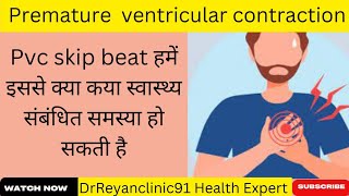 what is premature ventricular contraction।PVC Skip beat होने के कारण [upl. by Isidora]