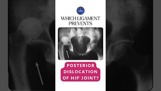 Which ligament prevents the posterior dislocation of hip joint shorts hipjoint ligaments [upl. by Friedlander386]