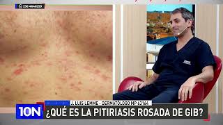 ¿Qué es la pitiriasis rosada de gib [upl. by Nikolaos]