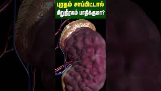 புரதம் சாப்பிட்டால் சிறுநீரகம் பாதிக்குமா  Does eating protein affect the kidney  Dr Arunkumar [upl. by Kale]