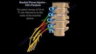 Brachial Plexus Injuries Erbs Paralysis  Everything You Need To Know  Dr Nabil Ebraheim [upl. by Lenette]