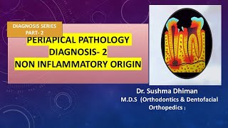 Periapical Pathology  Non inflammatory and non odontogenic lesions [upl. by Alrzc]