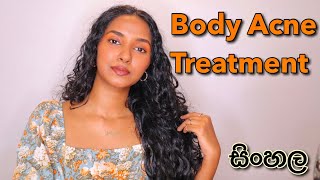 Body Acne Treatments In Sinhala  Chicken Skin Treatments  How To Get Rid Of Body Acne Sinhala [upl. by Assil]