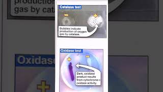 Catalase and oxidase test [upl. by Victoria59]