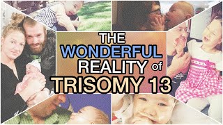 The Wonderful Reality of Having a Trisomy Child  Trisomy 13  Patau Syndrome 13トリソミー [upl. by Danette564]