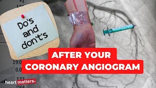 Post your coronary angiogram  What to know [upl. by Chitkara312]