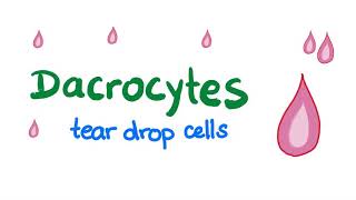 Dacrocytes Teardrop Cells [upl. by Anilram]