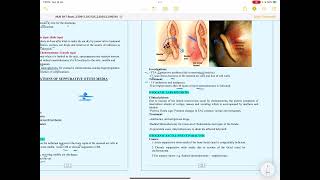 Complications of suppurative otitis media [upl. by Nanreit]