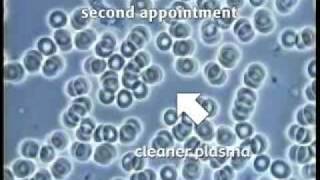 Live Blood Microscopy Demonstration Part 1 [upl. by Irrep845]