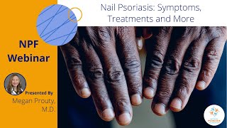 Nail Psoriasis Symptoms Treatments and More [upl. by Previdi404]