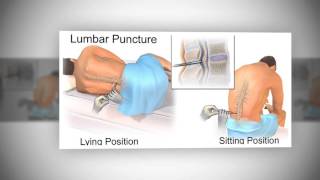 Lumbar Puncture LP [upl. by Alleiram]