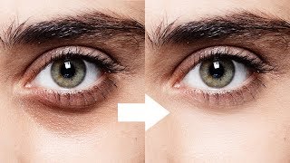 1Minute Photoshop  Remove Dark Circles Naturally [upl. by Aillemac]