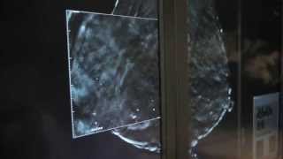 Hologic 3D mammography video [upl. by Irina]