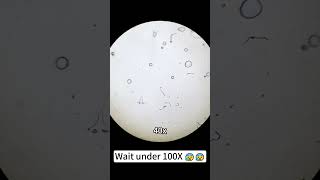 Yakult look cool at 400x magnification underthemicroscope microscope scienceshorts [upl. by Phene]