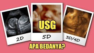 Inilah Perbedaan USG 2D 3D 4D amp 5D Yang Perlu Diketahui Ibu Hamil [upl. by Nrubliw]