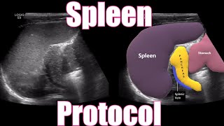 Spleen Protocol [upl. by Wallace388]