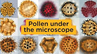 Pollen under the microscope [upl. by Anirba]