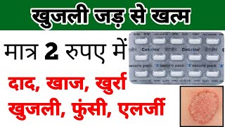 cetirizine tablet  cetirizine tablet uses in hindi  खुजली की गोली [upl. by Alansen499]