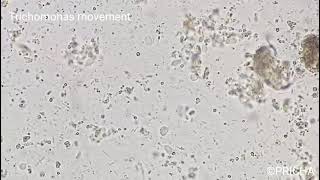 Trichomonas movement in stool examination [upl. by Lefty]