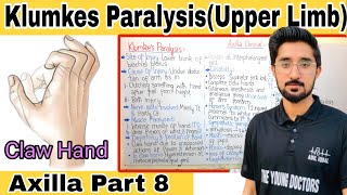 Klumkes Paralysis Brachial Plexus Clinical Klumpke Paralysis Brachial Plexus Clinical Anatomy [upl. by Christalle631]