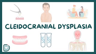 Cleidocranial Dysplasia Causes Diagnosis Types and Management [upl. by Eimam74]