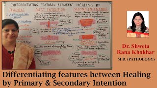 Differentiating features between Healing by Primary amp Secondary Intention [upl. by Ytima]