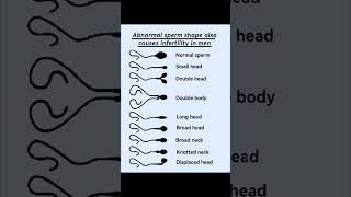 abnormal sperm shape  Human sperms [upl. by Nomla]