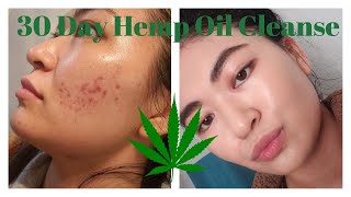 I Used Hemp Oil for 30 Days and This is What Happened [upl. by Anaderol999]