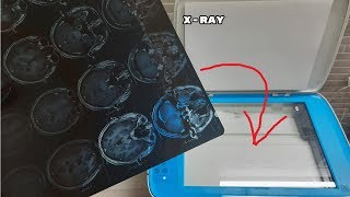 What Happens When You Photocopy An XRay [upl. by Noivad]