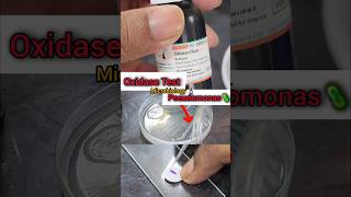 Oxidase Test 🧫🧪🔬🦠 Biochemicaltest  Microbiology Lab  Basics biochemistry shorts microbiology [upl. by Ahsyekat]