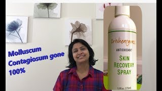 HOW TO TREAT MOLLUSCUM CONTAGIOSUM TRY Dr Wheatgrass skin recovery spray works 100 [upl. by Redd]