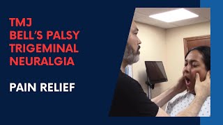 TMJ Bells Palsy and Trigeminal Neuralgia PAIN RELIEF by Dr Suh [upl. by Ilowell]