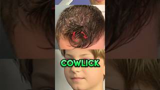 Cowlick problems 😭 [upl. by Checani]