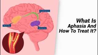 What Is Aphasia And How To Treat It [upl. by Bernadina]