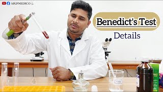 Benedicts Test  PrincipleProcedure and result  Benedicts Bangla benedicttest [upl. by Fionnula]