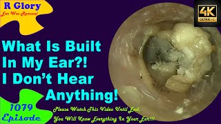 What Is Built In My Ear😴I Dont Hear Anything😏New Video Ear Wax Removal😍 1079 earwax ear [upl. by Aehsat]