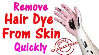 6 Ways to Remove Hair Dye From Skin at Home  How to Remove Hair Dye From Skin [upl. by Amora102]