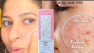 Acne skincare moisturiser  say goodbye 👋 to Dry skin cerasoft Beauteousskin moisturiser [upl. by Akihsal403]