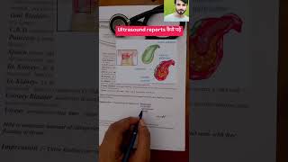 ultrasound report kaise dekhe  hepatomegaly with fatty liver  hepatomegaly [upl. by Eerb]