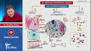 NIC Neoplasia intraepitelial cervical Papanicoloau Clasificación de Bethesda GINECOLOGÍA QX MEDIC [upl. by Esmerelda437]