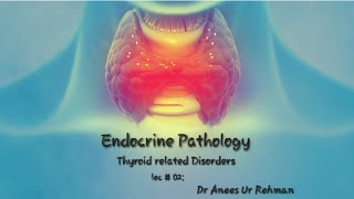 Graves Disease concept robbinsbasicpathology thyroid urdu [upl. by Elorac]