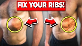 Fix Rib Flare In One Easy Exercise [upl. by Harifaz788]