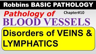 Ch10  Disorders of Veins amp Lymphatics  Blood Vessel Pathology  Robbins Lectures [upl. by Notgnirrac]