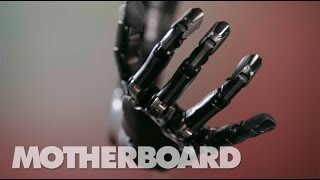 The MindControlled Bionic Arm With a Sense of Touch [upl. by Nuawed105]