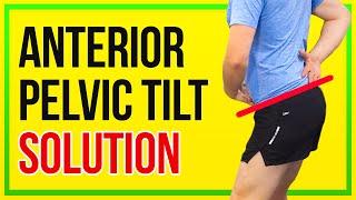 How to Fix Anterior Pelvic Tilt 4 KEY EXERCISES [upl. by Bolling]