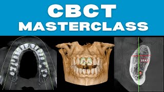 CBCT Masterclass With Real Case Discussions [upl. by Elisa888]