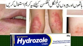 Hydrozole Cream Uses  Tee fatima [upl. by Benni]